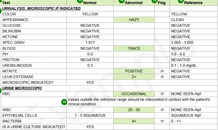 what-are-normal-urine-test-results